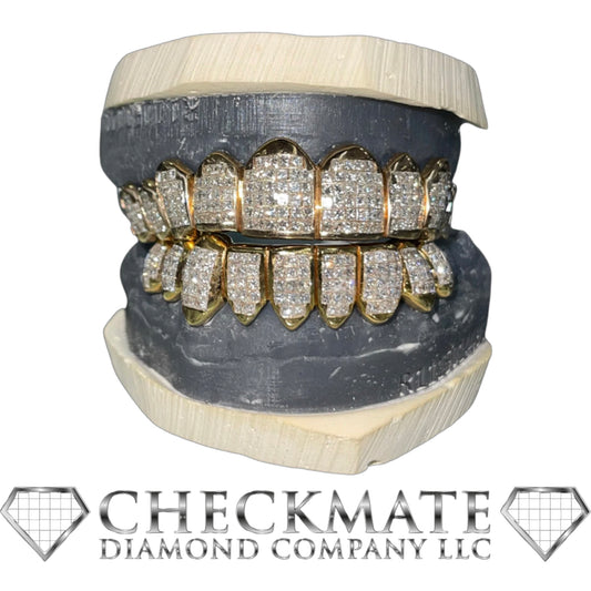 Diamond Grillz